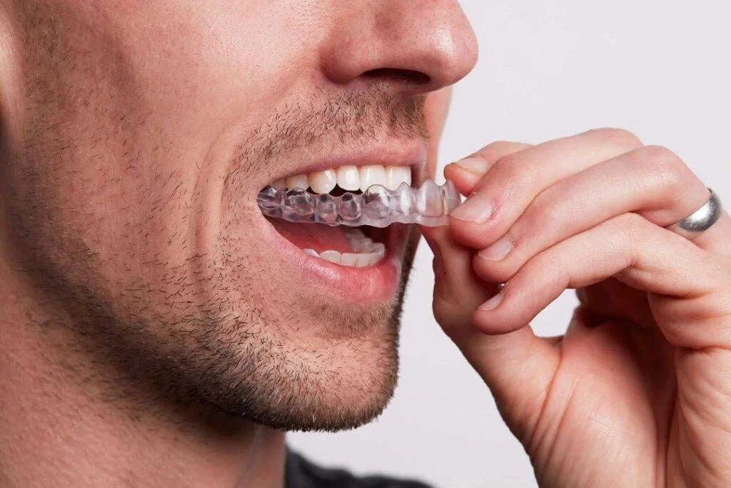 Sure Smile Aligners® au Cabinet dentaire Côté Gare Bussigny